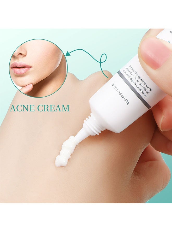 MEJISOO Acne Cream,Centella Moisturizer, Acne Cream for Face Natural Ingredients Professionally Remove Acne Marks,Centella Soothing Cream for Anti Acne Oil Control Pimple Lotion for Oily Acne Prone Skin - Image 5